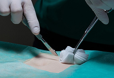 Oxycelulóza zachraňuje životy ve&nbsp;vojenských nemocnicích
