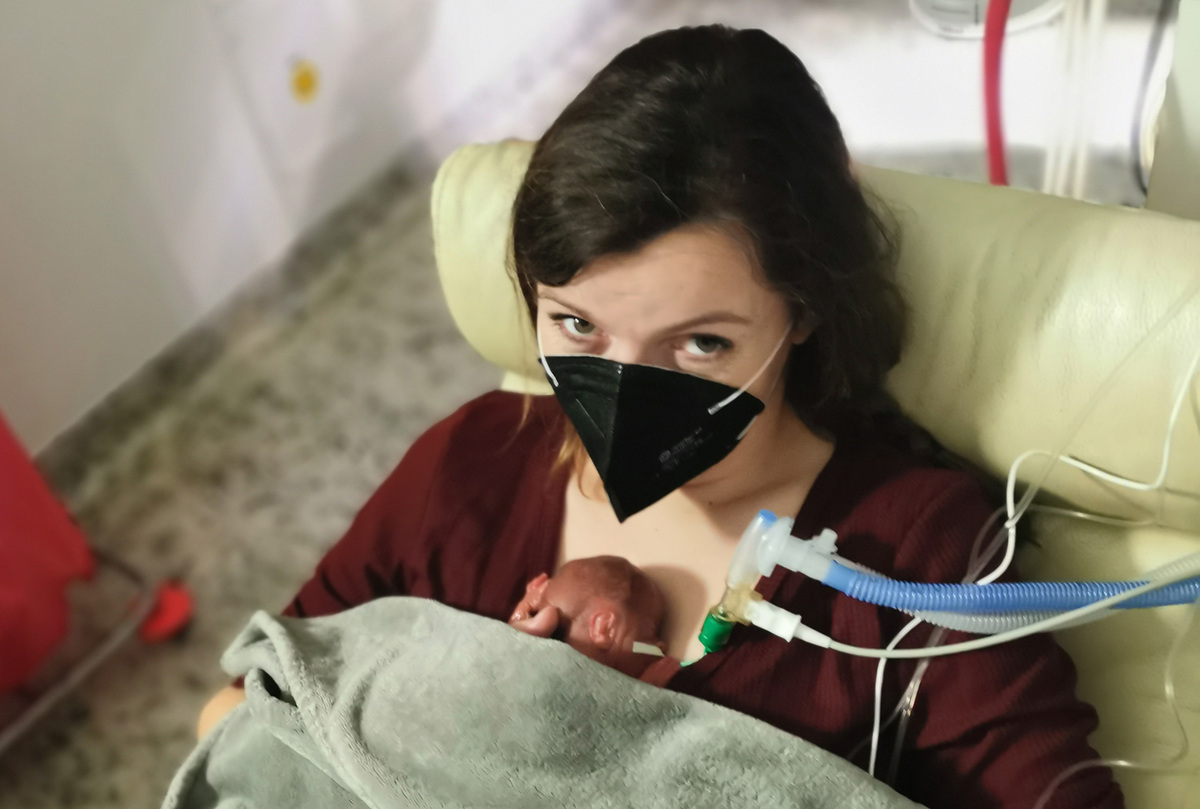 Foto: Syn zdravotnice Veroniky Rosické se narodil v šestém měsíci těhotenství s váhou půl kila a vešel se jí do dlaně | VFS